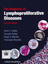 Image of Diagnosis of lymphoproliferative diseases
