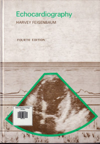 Image of Echocardiography