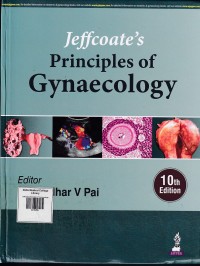 Image of Jeffcoate’s Principles of Gynaecology