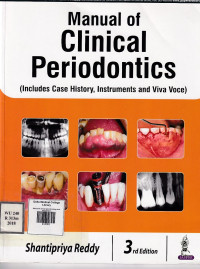 Image of Manual of clinical periodontology and periodontics