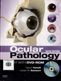 Image of Ocular pathology