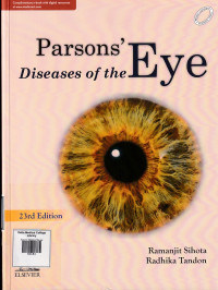 Image of Parson's diseases of the eye