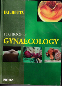 Image of Textbook of gynaecology